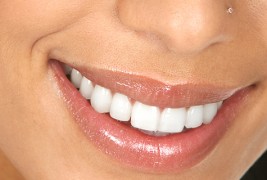 Како да ја одржите белината на вашите заби?