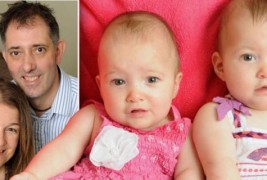 Близначка ù го спасила животот на сестра ù во мајчината утроба