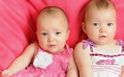 Близначка ù го спасила животот на сестра ù во мајчината утроба
