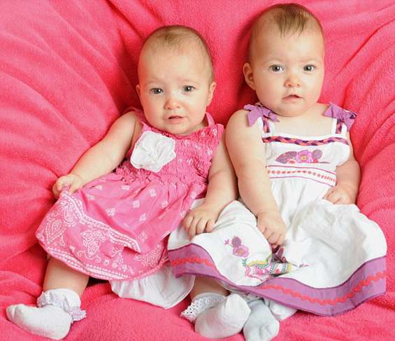 Близначка ѝ го спасила животот на сестра ѝ во мајчината утроба