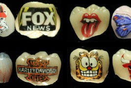 „Откачени“ тетоважи на заби