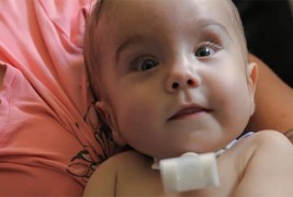 Доктори со 3Д печатач го спасиле животот на 3-месечно бебе