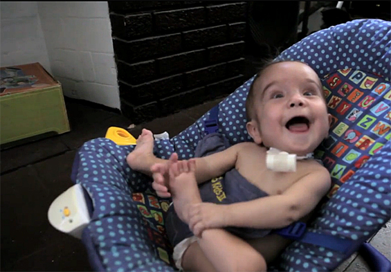 Доктори со 3Д печатач го спасиле животот на 3-месечно бебе