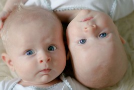 Најслатките бебиња-близначиња на интернет