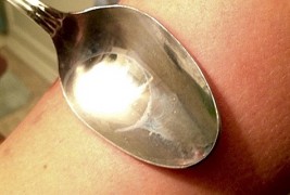 Трик: Ослободете се од чешањето по убод од комарец