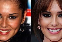 Како изгледале забите на познатите пред посетата на скап стоматолог?