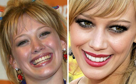 Како изгледале забите на познатите пред посетата на скап стоматолог?