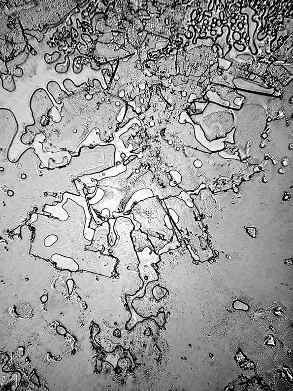 Погледнати под микроскоп, различни видови на солзи имаат различна структура