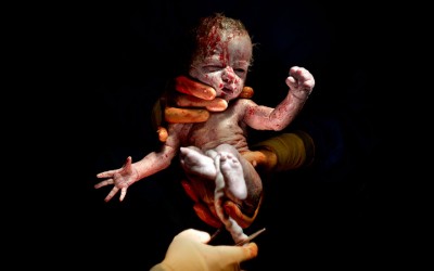 Фотографии од бебиња направени само неколку секунди по породувањето
