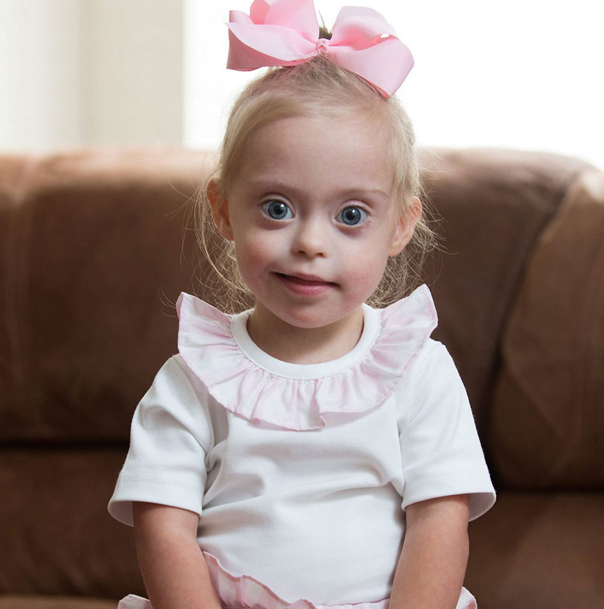(1) 2-годишно девојче со Даунов синдром добило договор од модна агенција поради својата слатка насмевка