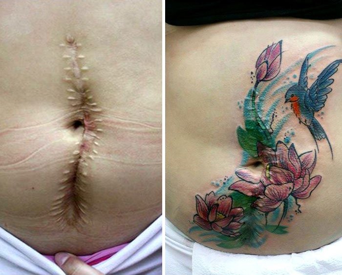 (2) Оваа жена прави бесплатни тетоважи со кои ги крие лузните од насилство и злоупотреба