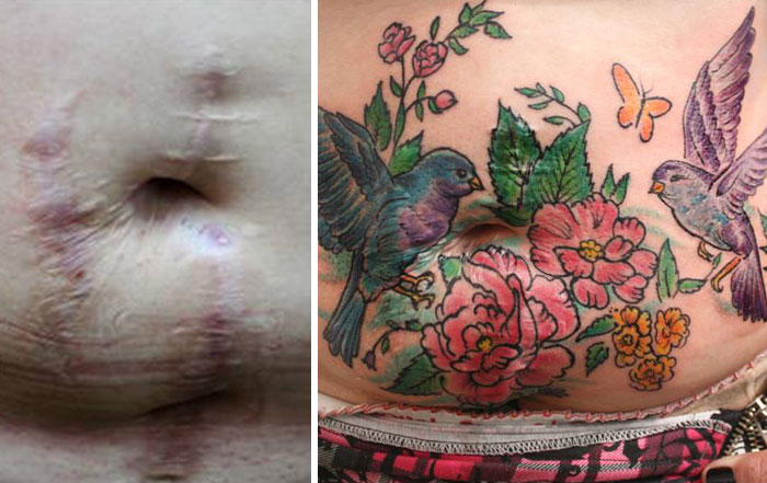 (5) Оваа жена прави бесплатни тетоважи со кои ги крие лузните од насилство и злоупотреба