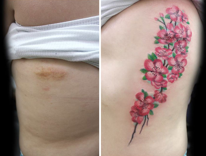 (7) Оваа жена прави бесплатни тетоважи со кои ги крие лузните од насилство и злоупотреба