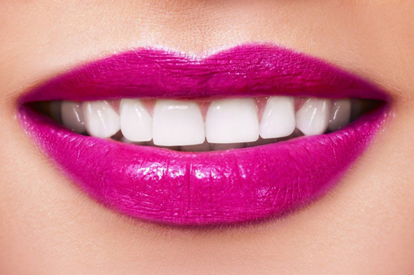 (2) Која боја на кармин да ја изберете летово за да ви изгледаат забите побели?