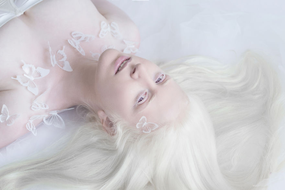 Волшебната убавина на албино луѓето прикажана преку прекрасни фотографии