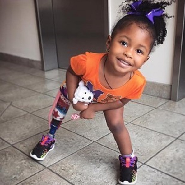 Инспирација и мотивација: 2-годишно девојче со вештачка нога е голема ѕвезда