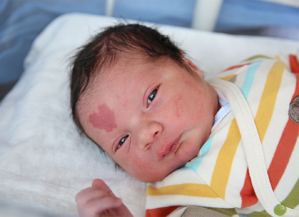 Не можете да не го сакате: Бебе родено со белег во облик на срце на неговото чело