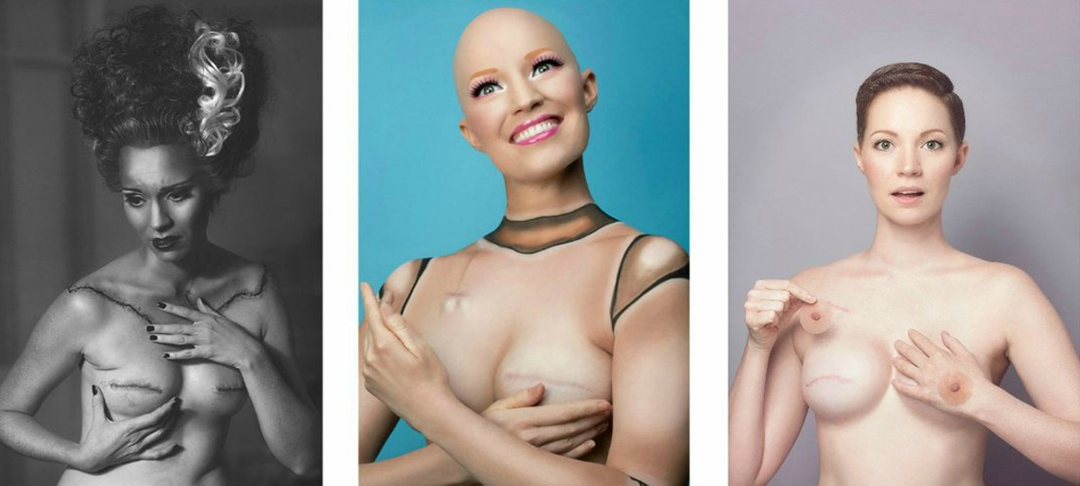 Проект со инспиративна цел: Зошто луѓето кои го победиле ракот не се жртви?