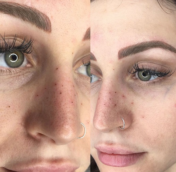 Тетовирање пеги на лицето: Нов тренд за убавина кој изгледа неодоливо