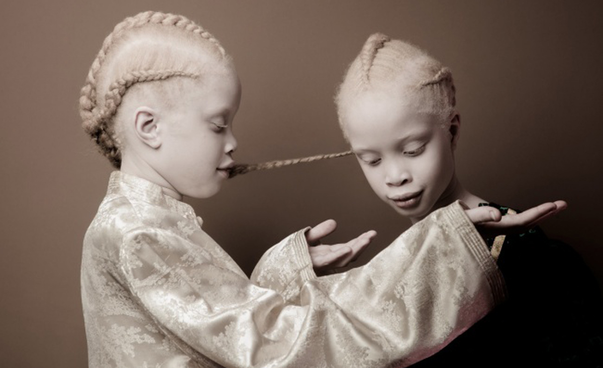 Погледнете ги овие необични близначки со волшебен изглед кои ќе ве остават без зборови