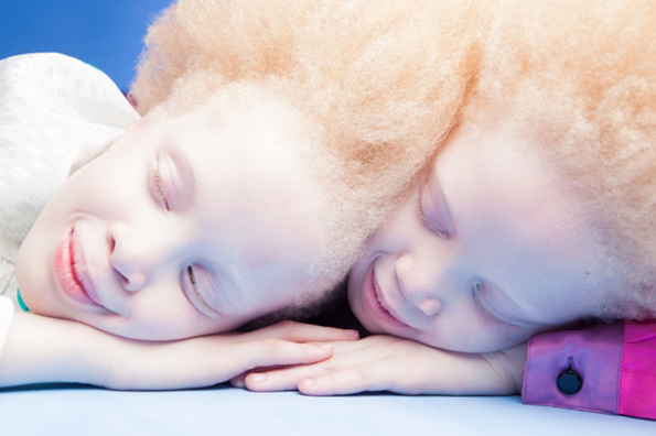 Погледнете ги овие необични близначки со волшебен изглед кои ќе ве остават без зборови
