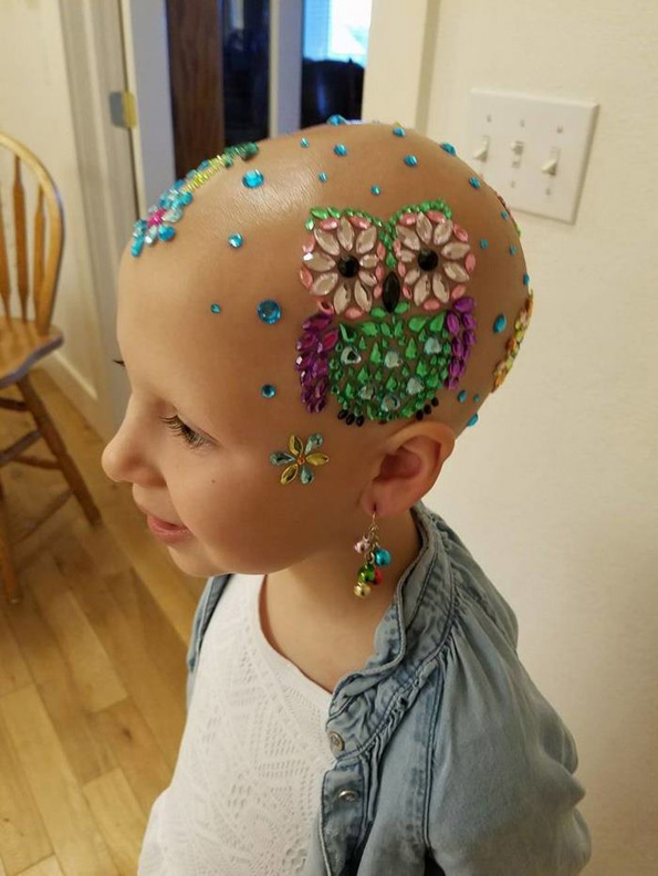7-годишно девојче со алопеција блесна на училиште со нејзината луда „фризура“ и покрај сериозната болест