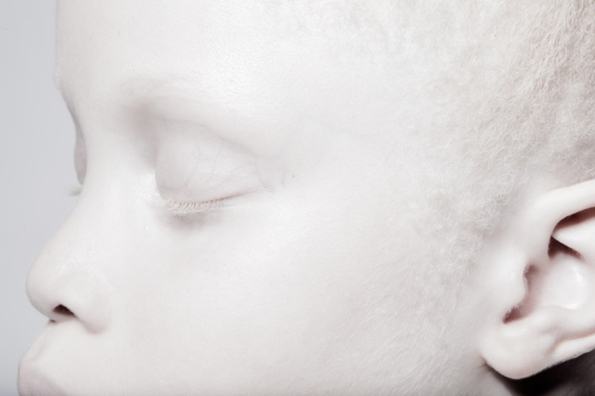 Погледнете ги овие необични близначки со волшебен изглед кои ќе ве остават без зборови