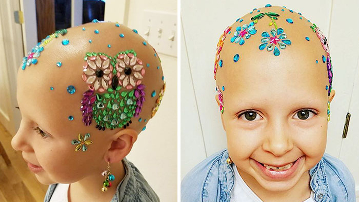 7-годишно девојче со алопеција блесна на училиште со нејзината луда „фризура“ и покрај сериозната болест