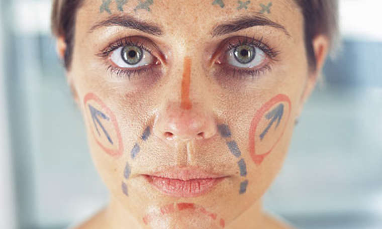 15-priznanija-na-lugje-koi-zazhalile-za-nivnata-plastichna-operacija-kafepauza.mk