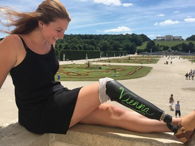 Девојка си ја претворила простетичката нога во табла за пишување и отишла на патување низ Европа