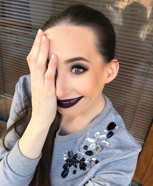 Запознајте ја Иванка Данисова: Моќни фотографии на жената родена со половина лице