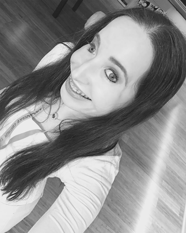 Запознајте ја Иванка Данисова: Моќни фотографии на жената родена со половина лице