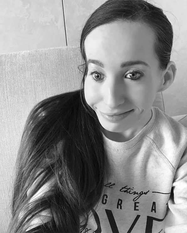 Запознајте ја Иванка Данисова: Моќни фотографии на жената родена со половина лице