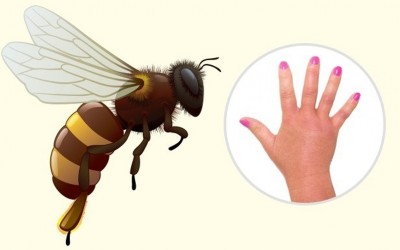 Како да ги препознаете најчестите убоди од инсекти?