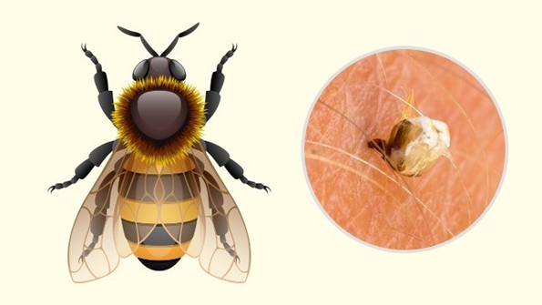 Како да ги препознаете најчестите убоди од инсекти?