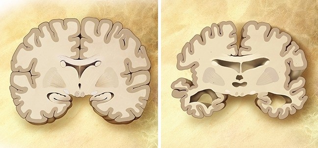 (3)13-neochekuvani-raboti-koi-se-shtetni-za-vashiot-mozok-kafepauza.mk