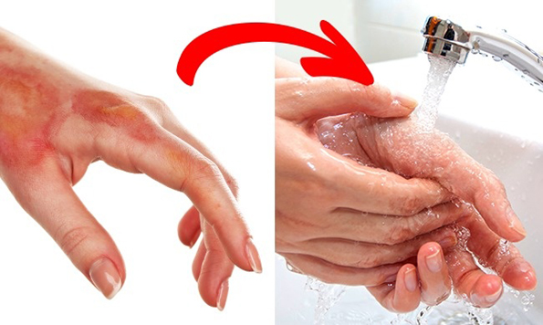 10 митови за пружање прва помош што сериозно можат да ви го нарушат здравјето