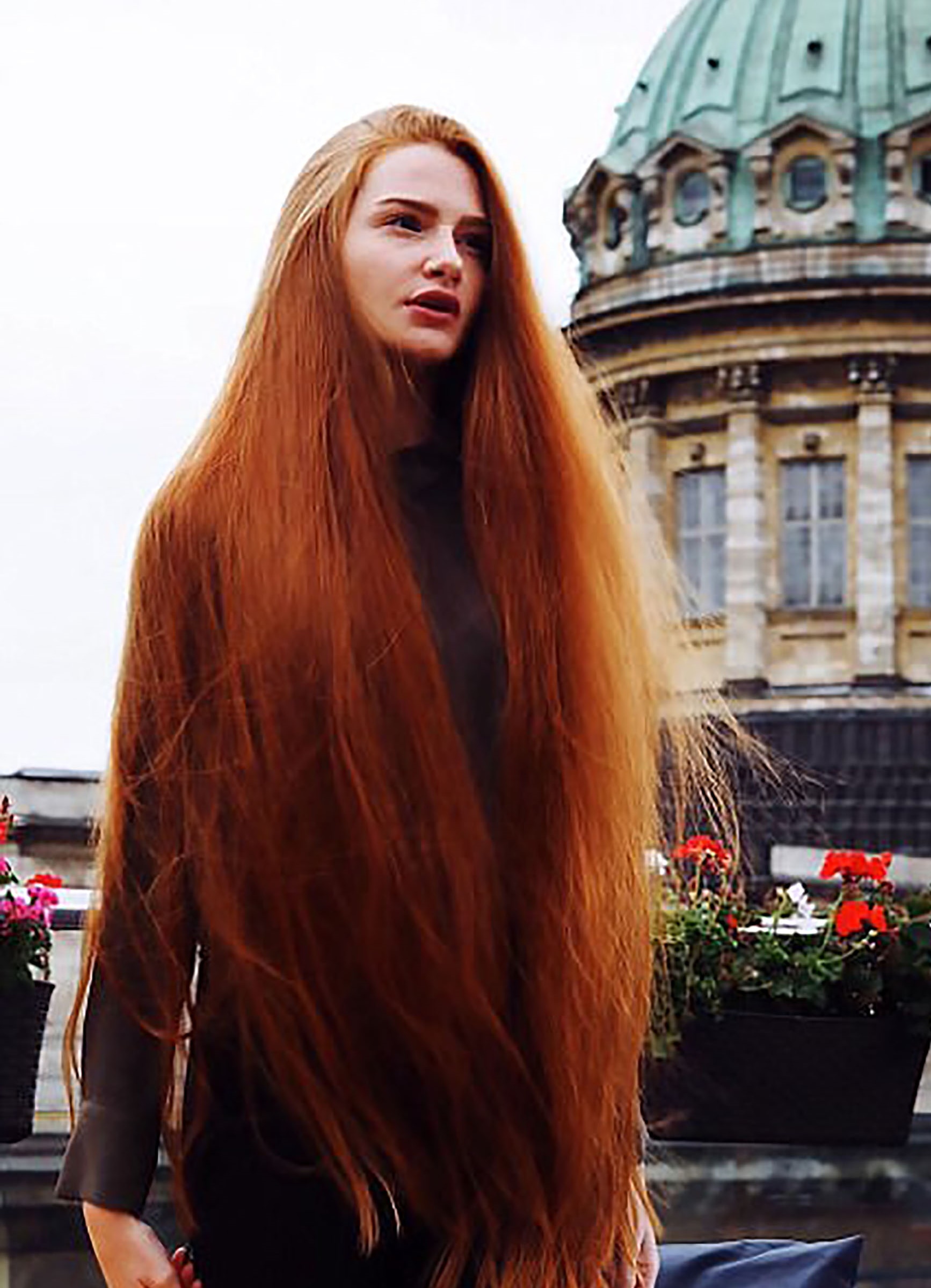 5-zaradi-zdravstvenite-narushuvanja-bila-kjelava-a-denes-e-model-na-shamponi-www.kafepauza.mk_