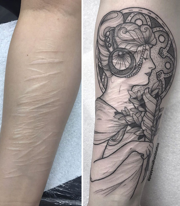 Девојка сакала да ги покрие лузните од самоповредување со тетоважи, но сите ја одбиле освен еден тату артист