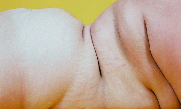 (12) Фотографии од луѓе кои биле малтретирани поради тоа што ги рушеле традиционалните стандарди за убавина