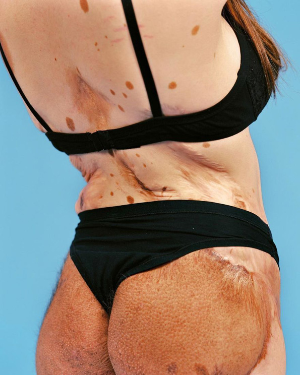 Фотографии од луѓе кои биле малтретирани поради тоа што ги рушеле традиционалните стандарди за убавина