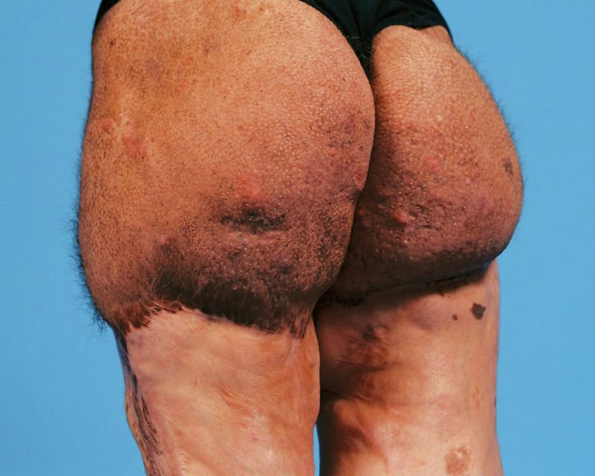 Фотографии од луѓе кои биле малтретирани поради тоа што ги рушеле традиционалните стандарди за убавина