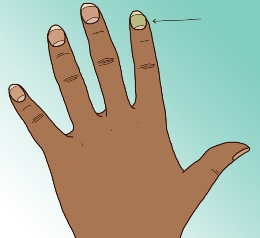 10 тајни кои ги кријат ноктите за вашето здравје