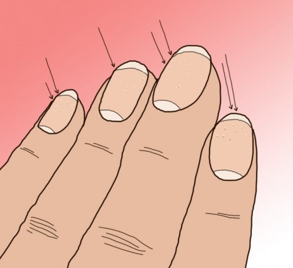 10 тајни кои ги кријат ноктите за вашето здравје