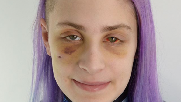 Фризер објавил фотографии од жртва на домашно насилство за да ја подигне свеста на народот