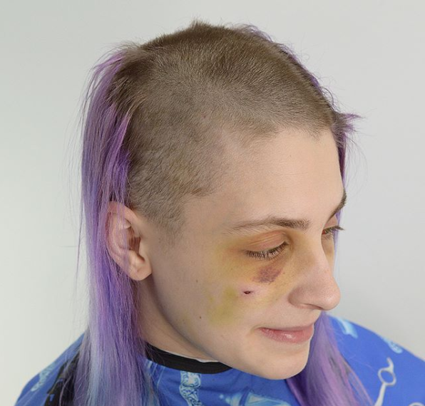 Фризер објавил фотографии од жртва на домашно насилство за да ја подигне свеста на народот