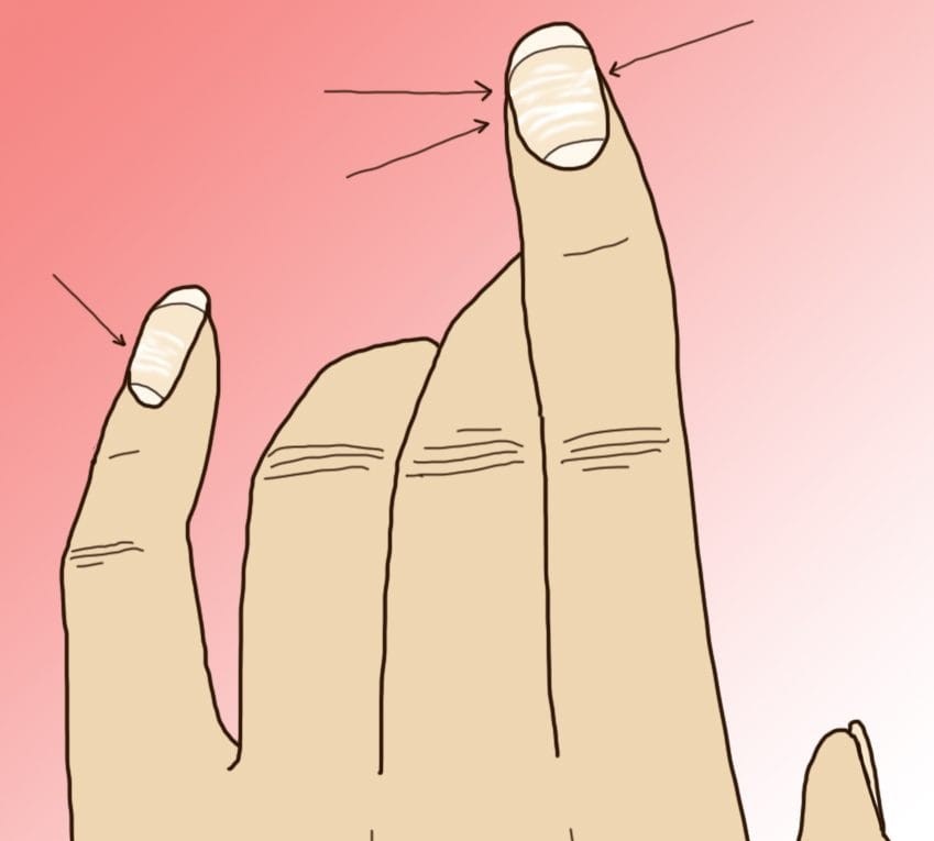 10 тајни кои ги кријат ноктите за вашето здравје