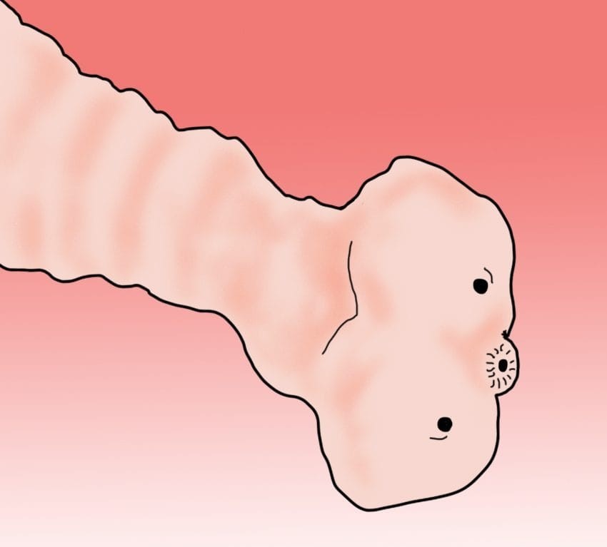 9 паразити што можеби веќе живеат во вашето тело