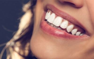 6 причини за пожолтување на забите