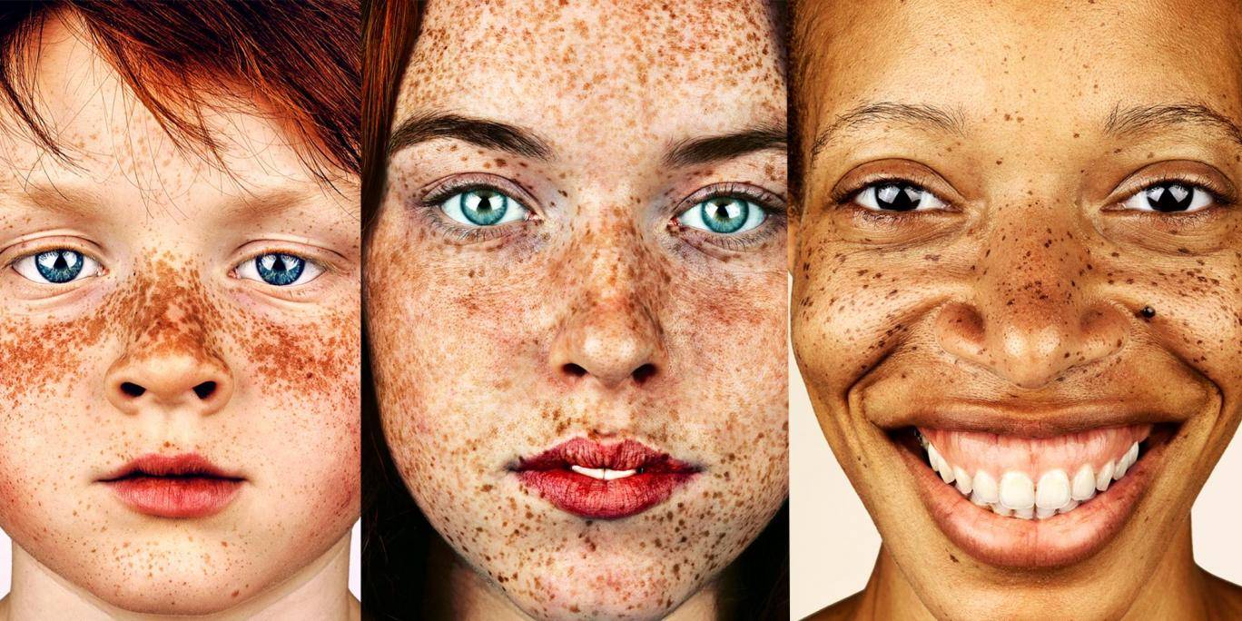 Фотограф прави неверојатни портрети од луѓе со пеги